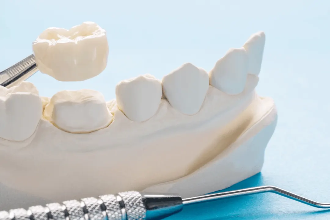 Dental crown model