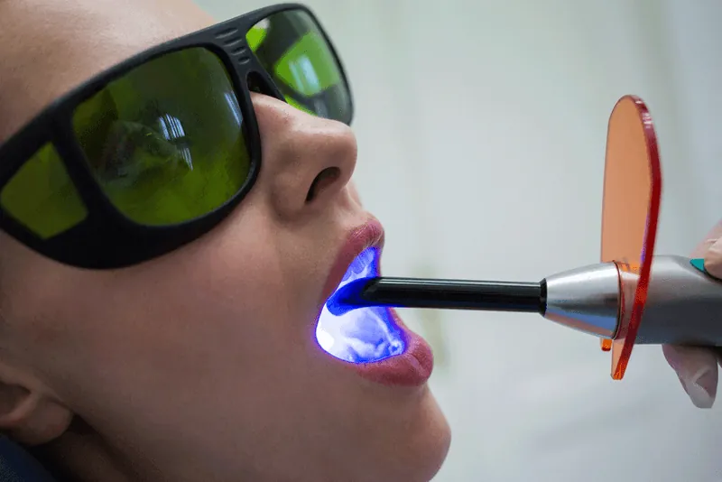 Dental laser treatment